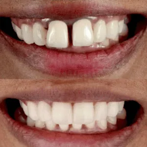 Real Smiles, Real Procedures