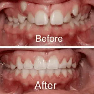 Real Smiles, Real Procedures