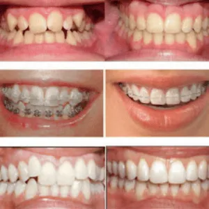 Real Smiles, Real Procedures
