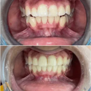 Real Smiles, Real Procedures