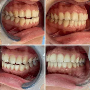 Real Smiles, Real Procedures