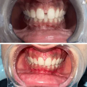 Real Smiles, Real Procedures