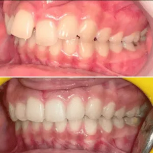Real Smiles, Real Procedures