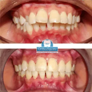 Real Smiles, Real Procedures