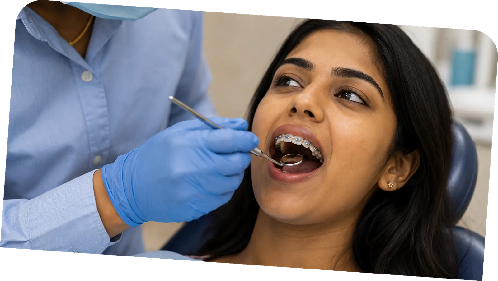 Consultation & smile assessment