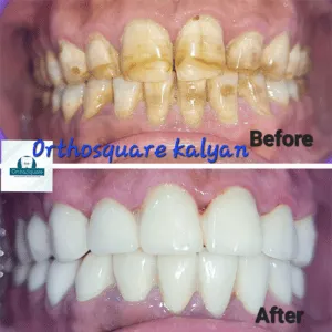 Real Smiles, Real Procedures