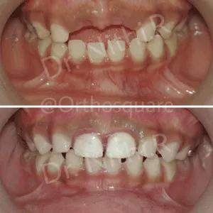 Real Smiles, Real Procedures