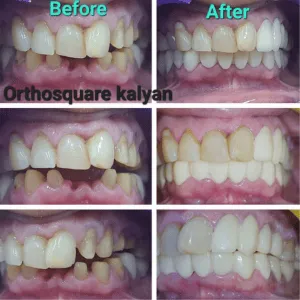 Real Smiles, Real Procedures
