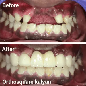 Real Smiles, Real Procedures