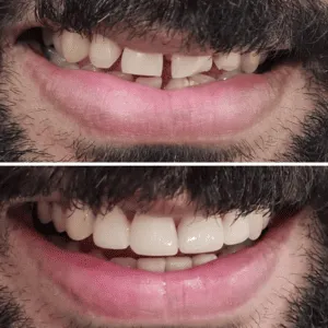 Real Smiles, Real Procedures