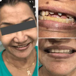 Real Smiles, Real Procedures