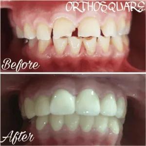 Real Smiles, Real Procedures