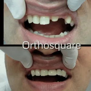 Real Smiles, Real Procedures