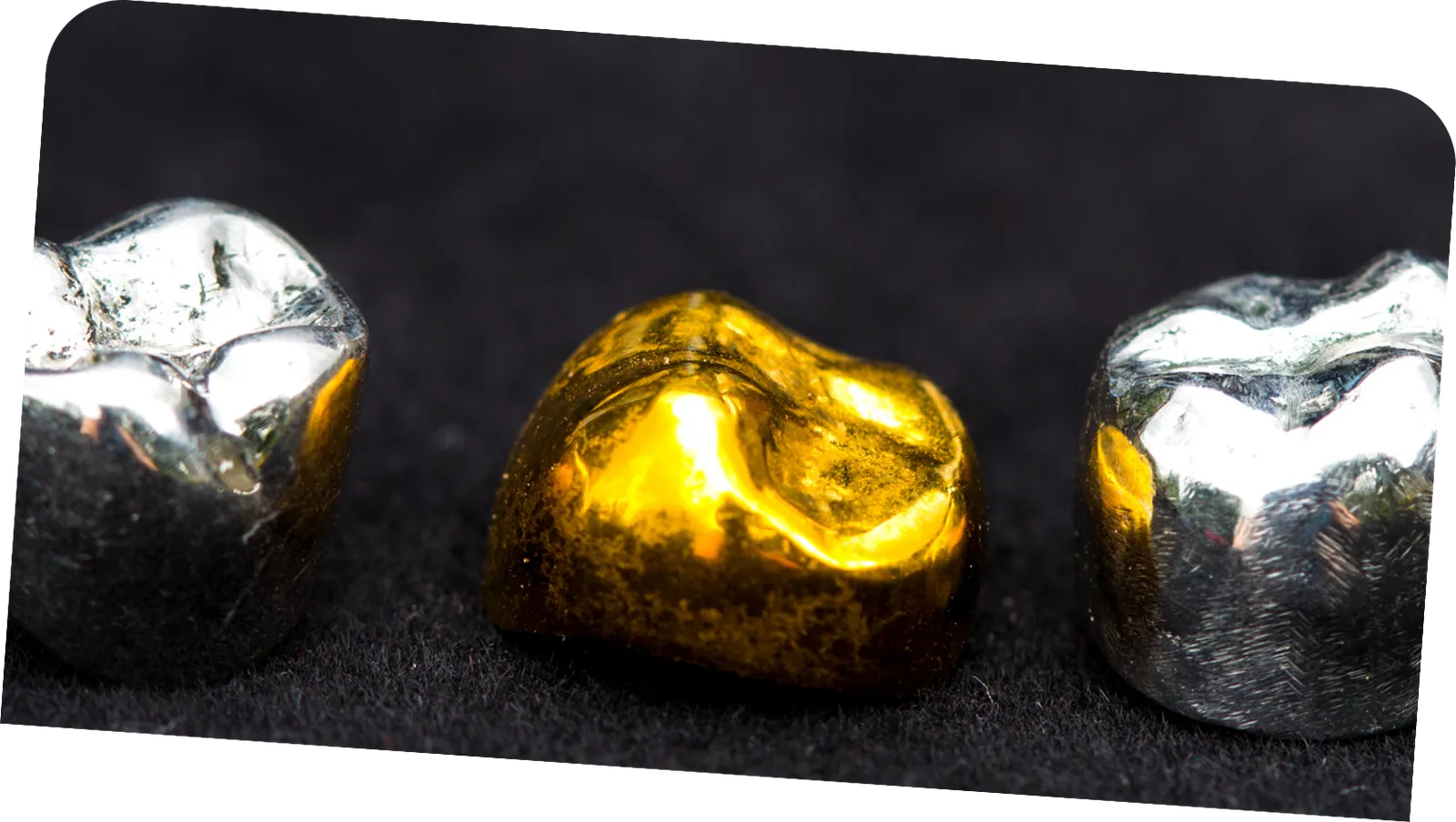 Metal crowns