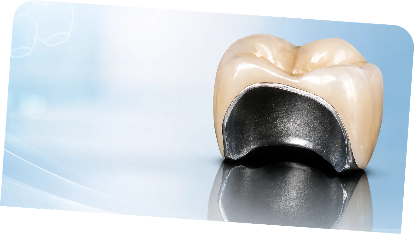 DMLS crowns