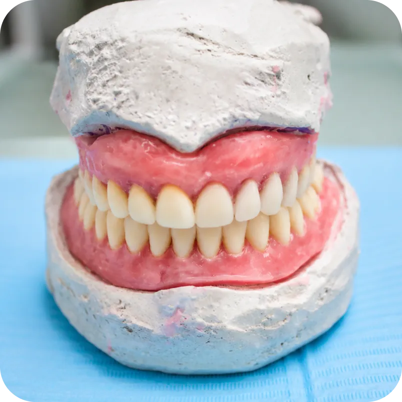 Dental implant close-up