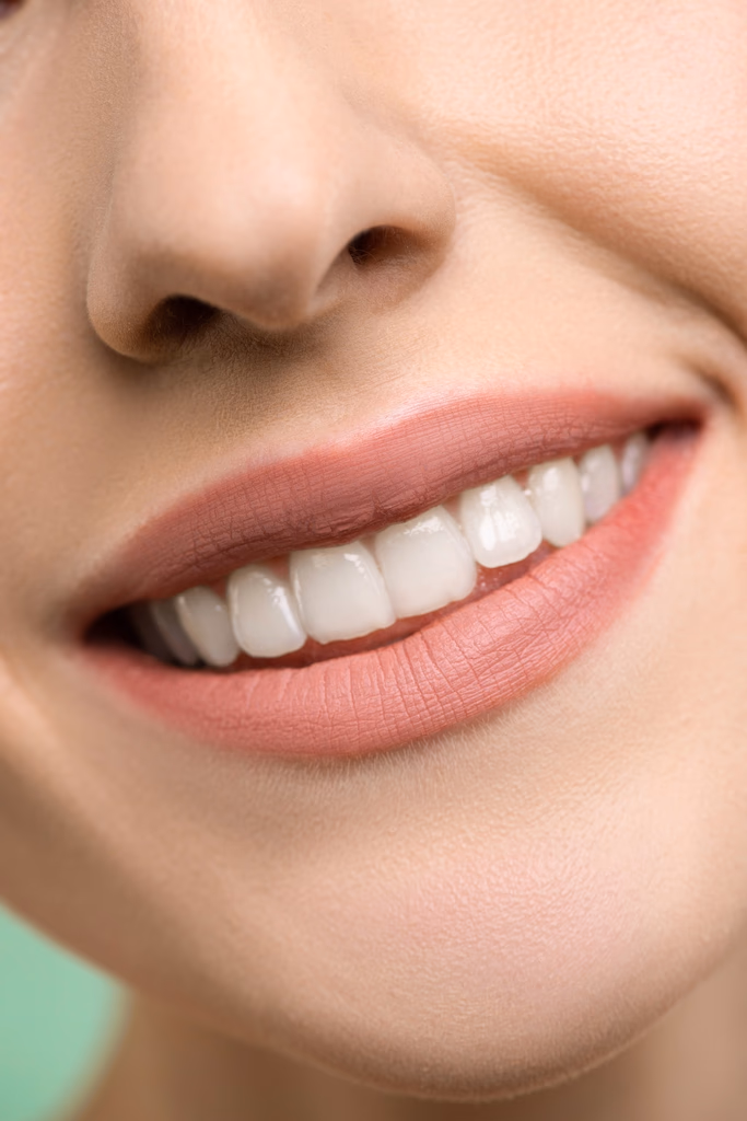 Teeth Whitening