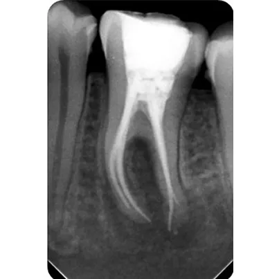 Real Smiles, Real Procedures