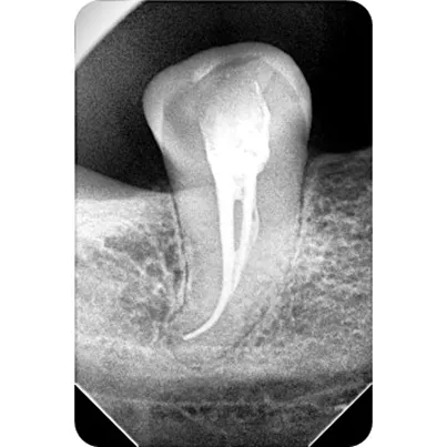 Real Smiles, Real Procedures