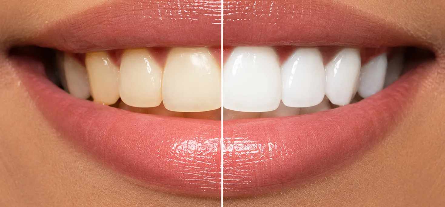 Helps whiten your teeth