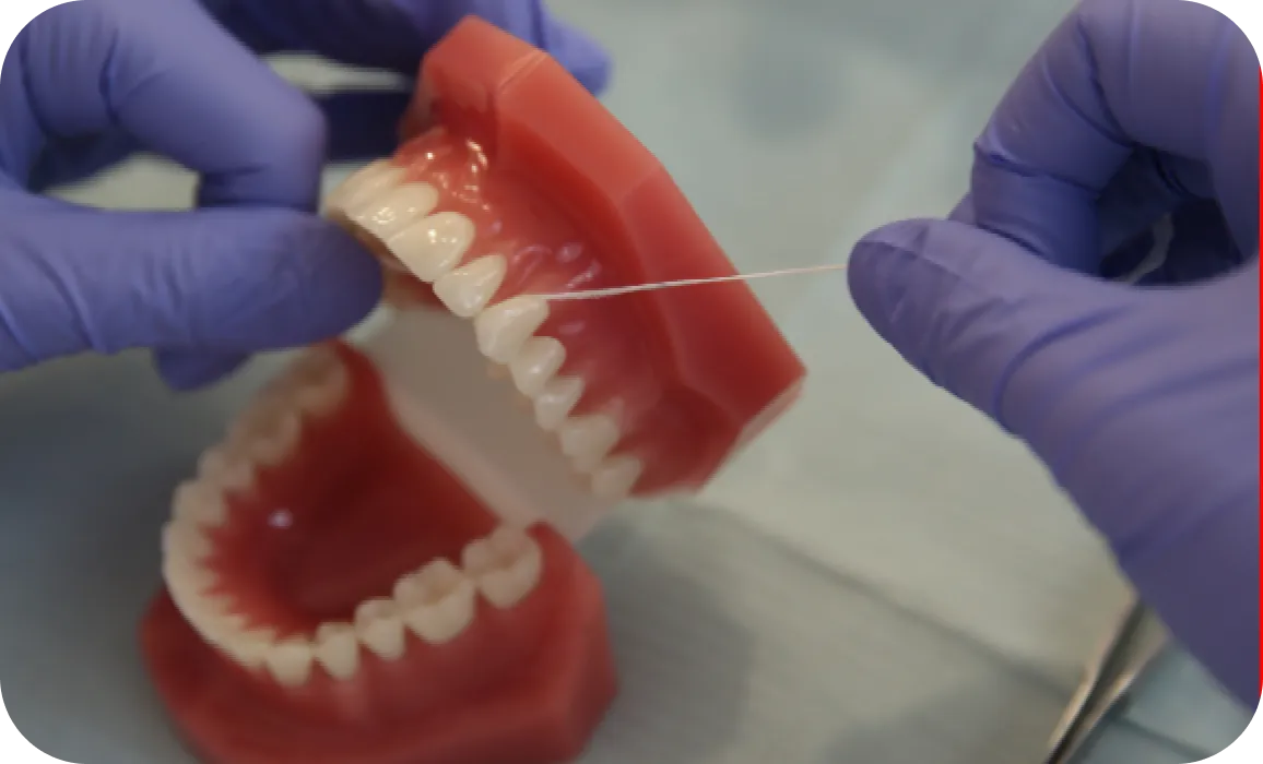 Smile makeover clean white teeth