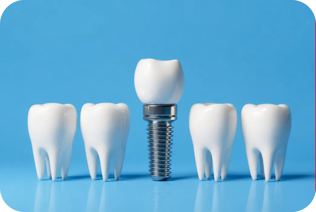 Advanced dental implants
