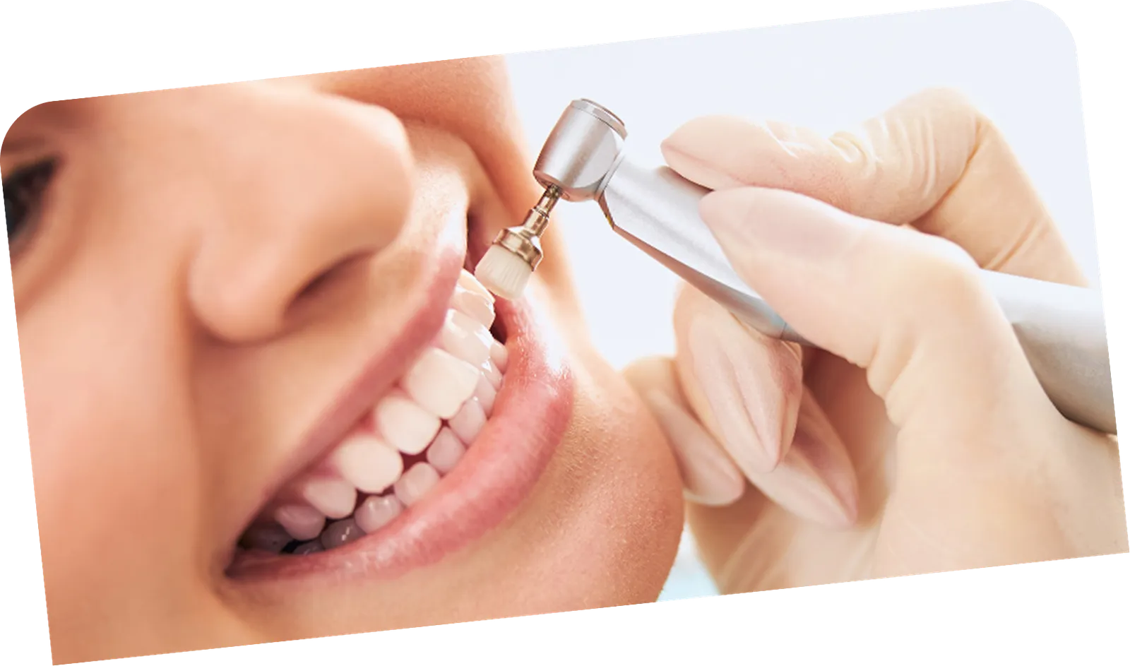Teeth cleaning & protection