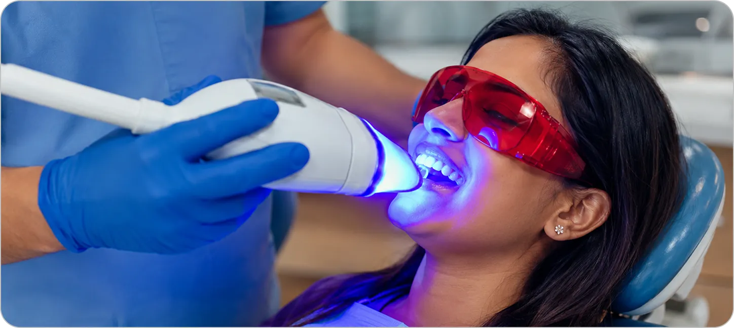 In-office Zoom whitening