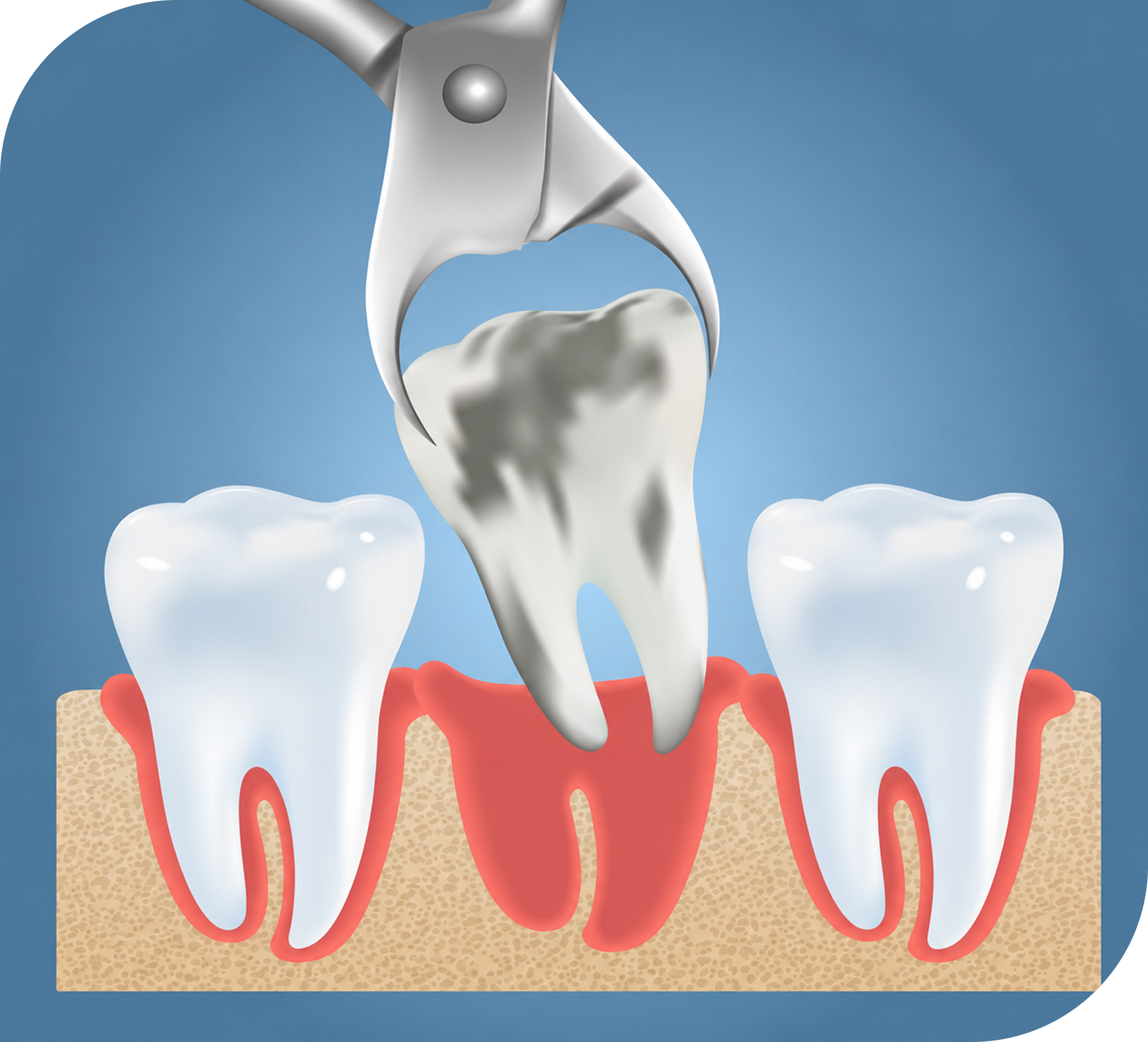 AVMSmiles Dental Clinic | Family & Cosmetic Dentistry