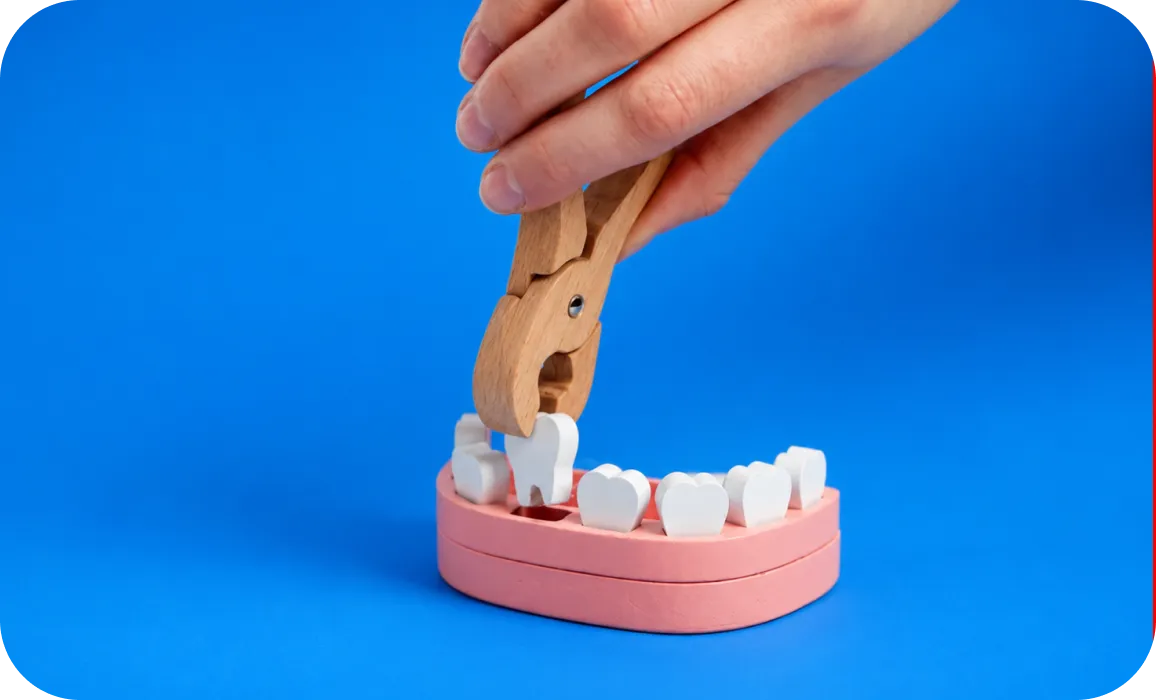 Smile makeover clean white teeth